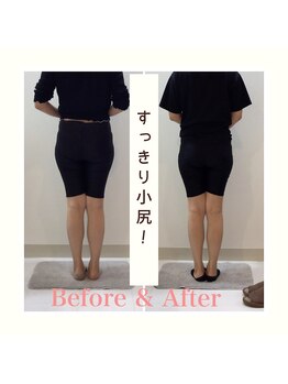 スタイルラボ高松/産後骨盤矯正の効果♪