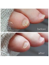 爪切り屋 足楽/