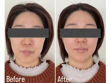 リタ(Rita.)/歪みも整う小顔矯正