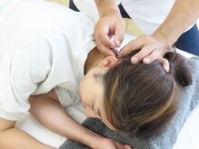 うちやまコンディショニングラボの雰囲気(鍼施術で原因解消!)