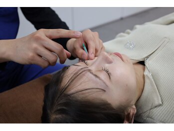 小林整骨院 三宮の写真/【オーダーメイド美容鍼】素肌から輝く、自分史上最高の美しさへ