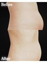 サンティエ(Santie)/ポッコリお腹は危険