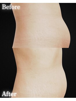 サンティエ(Santie)/ポッコリお腹は危険