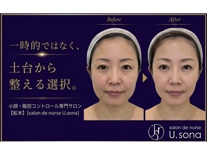 小顔・脂肪コントロール専門 salon de nurse U.sona～松本店～の写真