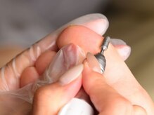 テラスアヴェダ 心斎橋店(Terrace AVEDA)/角質除去＋魚の目タコ除去！