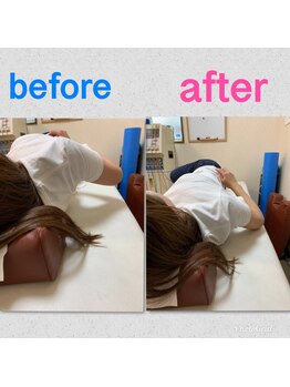 スモール フェアリー(Small Fairy)/背中のこわばり改善