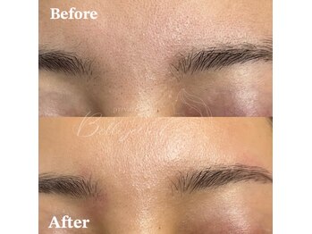 ベルアイラッシュ(Belleyelash)/【フェイシャルワックス】