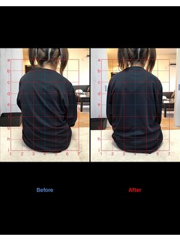 ボディクラフト/【施術例】背骨の歪み