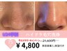 【学割U24】¥21,600→¥4,800【ハイドラ毛穴洗浄】