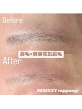 リゼクシー INTERNATIONAL麻布十番 六本木(RESEXXY)/眉毛脱毛/美容電気脱毛