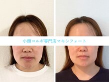 マキシフォート 名駅店(Maxifort)の雰囲気（痛きもちいいコルギで顔はもちろんボディのスッキリ感も大好評◎）