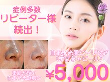 リプラス(Replus)