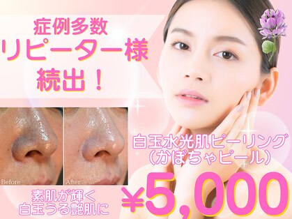 リプラス(Replus)の写真