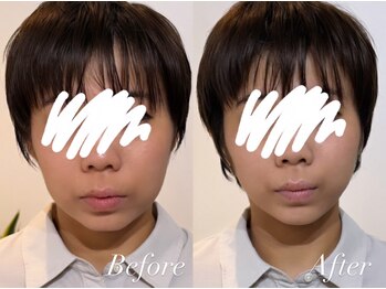 ハクト(Hakuto)/Before/After