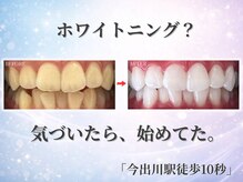 ホワイトニングショップ 今出川店(WHITENING SHOP)