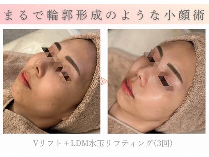 アマテラススキンラウンジ(Amatelas SKIN LOUNGE)の写真