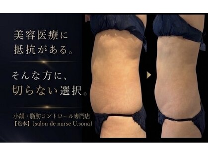 小顔・脂肪コントロール専門 salon de nurse U.sona～松本店～の写真