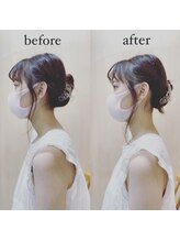 アンド リラクゼーション フレイ整骨院(&Relaxation)/スマホ首/巻き肩(整体)