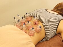 亀貝わかば整骨院/カッピング付きプラン多数有り♪