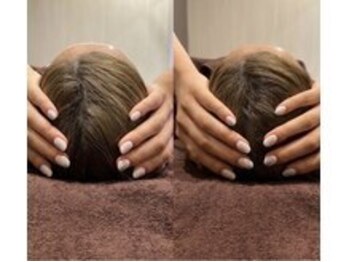 スキンベイビー 池袋店(Skin Baby)/頭蓋骨リセット