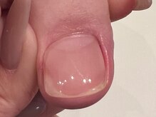 エナネイル(ENA nail)