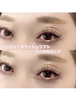 レディエント(Radiant)/パリジェンヌ/メーテルロッド