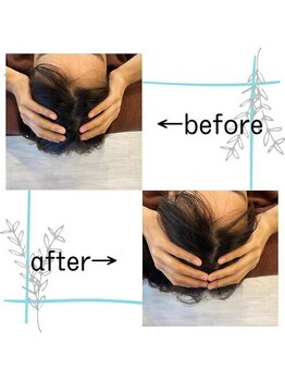 りらすぱ 上野 御徒町/頭皮スッキリ