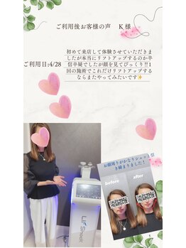サンスタイルクリア 守山店(SUN STYLE CLEAR)/小顔リフショック利用者様のお声