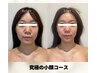 【後悔しない花嫁美容】半年前スタート★月2回で貴方史上No.1の姿へ¥19,500→