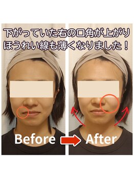 ラヴィフルリル(Ravi FleuRir)/小顔矯正ヘッドスパの変化