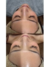 フォビィサロン(FOBE...salon)/ビオフィート