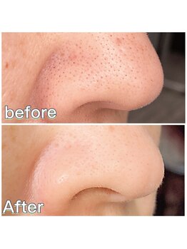 ミラ 中央林間(mira)/小顔　毛穴　ホワイトニング