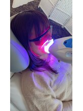 ペルラメディカルホワイトニング 名古屋/【人気No.1】美白体験