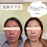 ホルバールウェルネス(Hallbar Wellness)