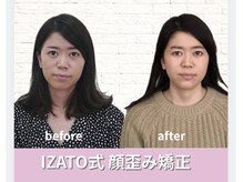 小顔矯正 イザト整体院(IZATO)/顔歪み矯正before＆after