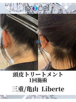 リベルテ(Liberte)/プロセル頭皮トリートメント
