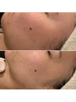 オリエンタルビューティー(ORIENTAL BEAUTY)の写真/最近顔が疲れて見える…たるみ・フェイスラインのもたつきを整え、自信あふれる表情をサポート♪