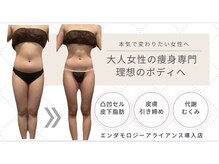 ビューティーマックス エースタジオ(Beauty MAX Astudio)