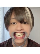 プラチナムビューティ 渋谷店(PLATINUM Beauty)/ホワイトニング