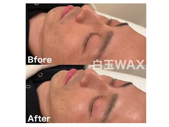 エレーナ(ELENA)/men's白玉WAX+炭酸パック＋骨気