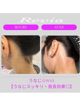 レビア(Revia)/☆うなじ/横顔美人before→after