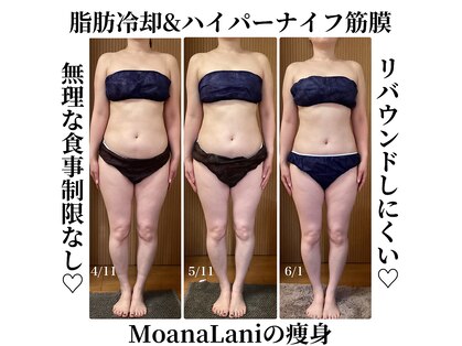 モアナラニ(MoanaLani)の写真