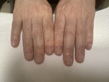 シープラス/縦割れ爪を綺麗にカバー