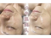 サロンデュ ひゃーく(Salon du ひゃーく)/今日から貴方もツヤ肌美人に・・