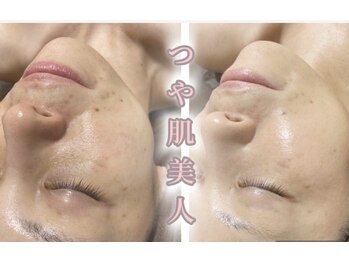 サロンデュ ひゃーく(Salon du ひゃーく)/今日から貴方もツヤ肌美人に・・