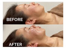 エクラプラス(eclat plus)の雰囲気（凝り固まっている筋肉を緩めてほぐす♪最強オールハンド小顔矯正）