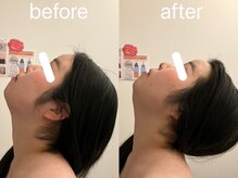 ヴィセラ(Vicella)/首の可動域アップ！