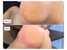 カシェット(Cachette)/40代女性◎足裏角質ケア90分