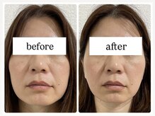 骨格美容サロン