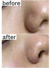 プルティティア 池下 今池 覚王山(Pultitia)/